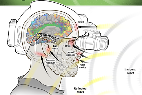 Drawing of a soldier showing how the face is impacted by exposure to repeated blast