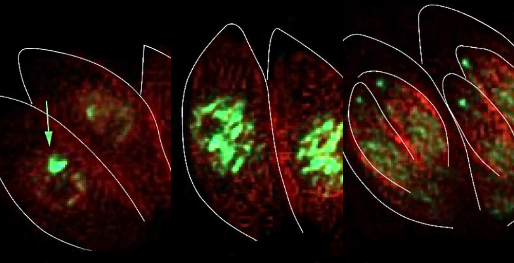 Fluorescent tagging of the PCNA1 protein 