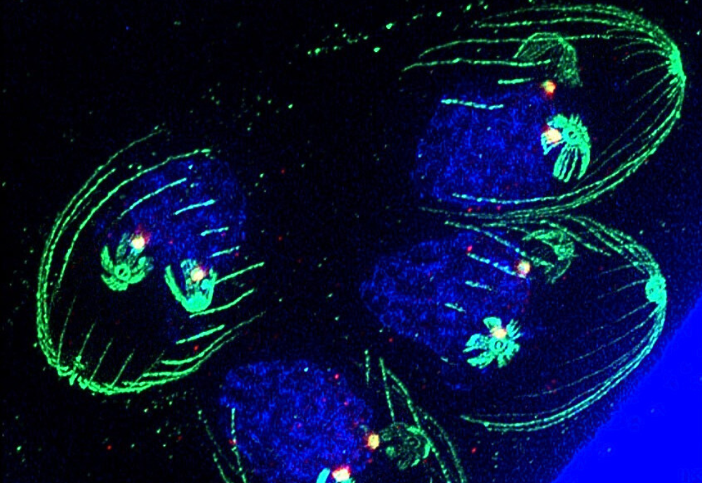 Fluorescent microscopy image of Toxoplasma gondii. 
