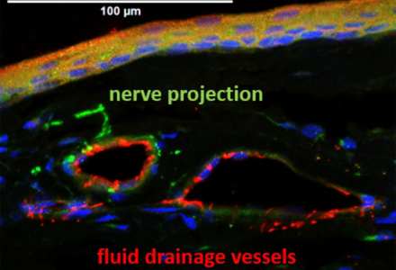 Nerve projection image