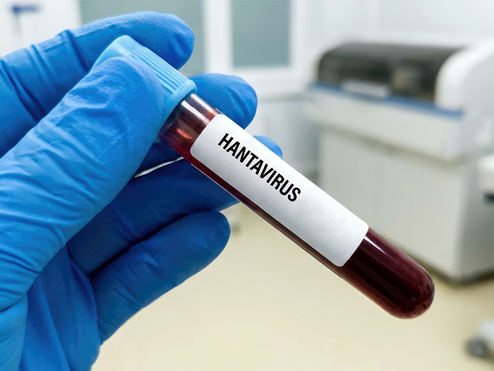What to know about hantavirus after cruise ship outbreak