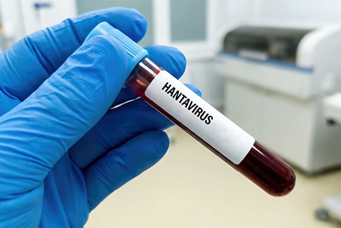 Lab technician holds vial of blood that says, 