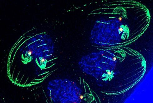 Fluorescent microscopy image of Toxoplasma gondii. 