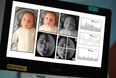 Screenshot on computer featuring facial recognition software on an infant