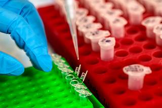 lab vials