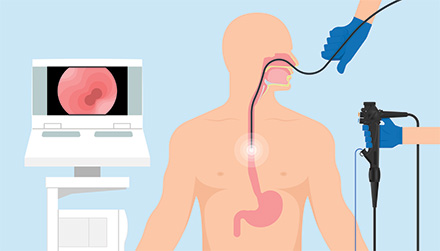 endoscopy