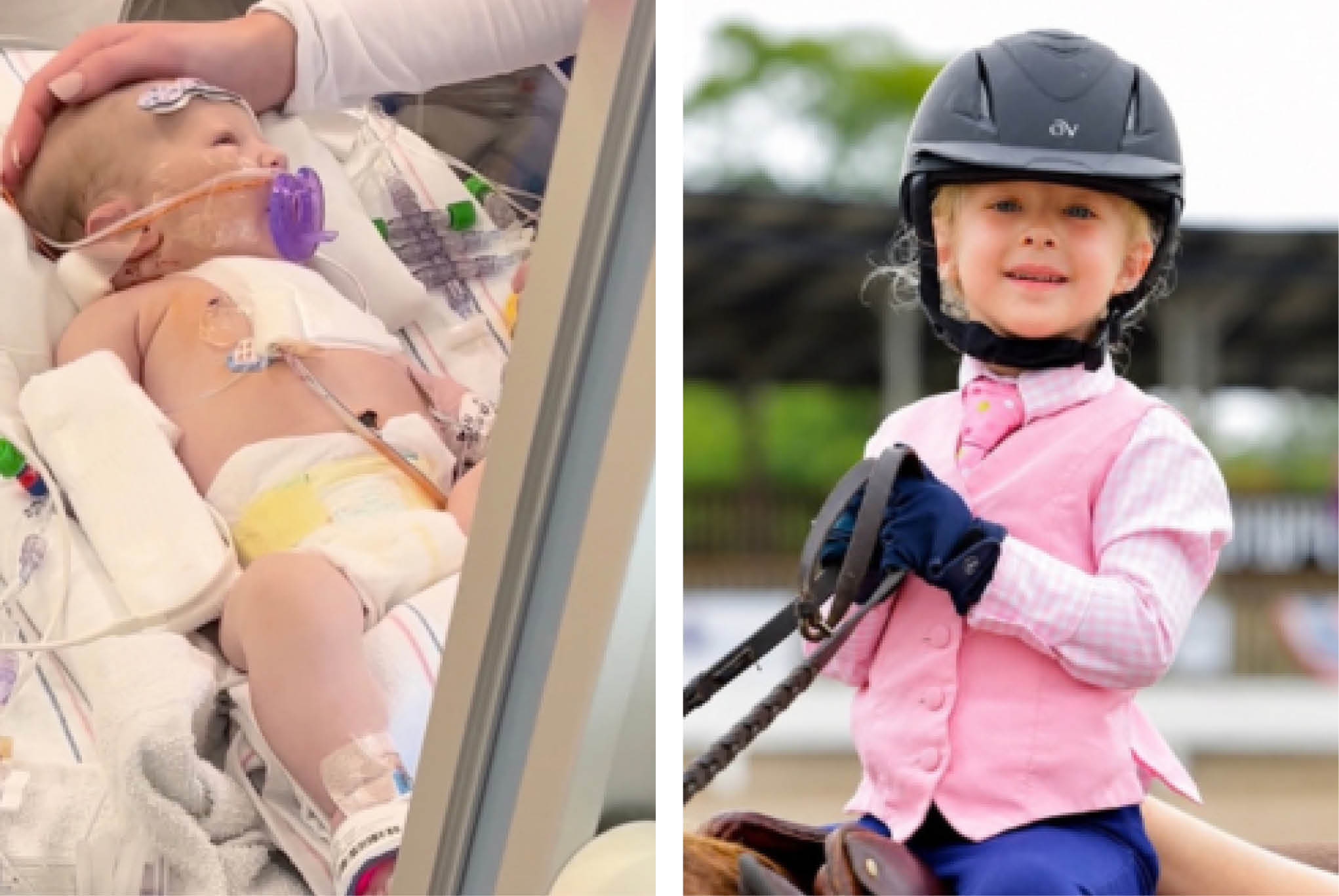 A two column image of Meadow Boes as a baby being medically treated, and her as a small child riding a horse