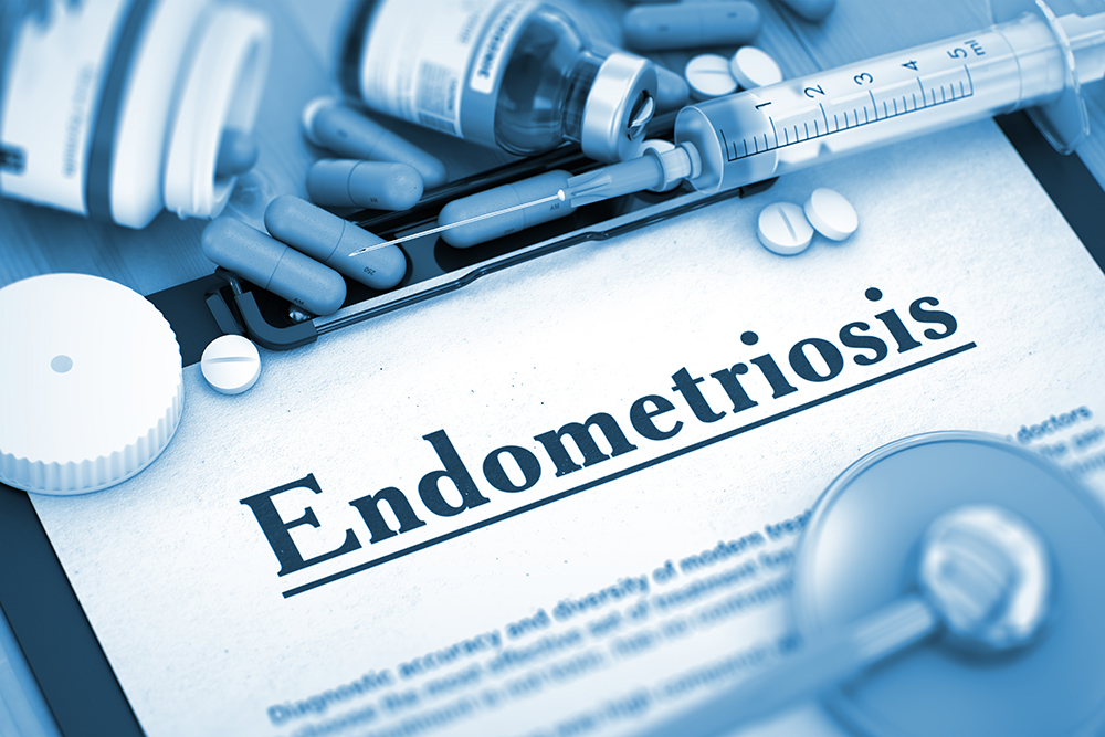 Endometriosis