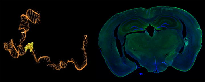 Images from Dr. Nikita Patel’s team’s preliminary research. Right: Molecular simulation shows robust and stable binding of the small molecule therapeutic. Left: Brain scans indicating the therapeutic administered intranasally distributes across all regions of the brain with high efficacy and no in-vivo toxicity.