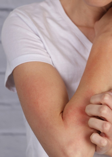 Seeking Drug Discovery Projects Targeting Itch in Inflammatory Conditions