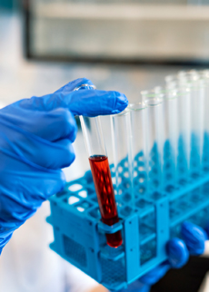 Hypothesis Testing