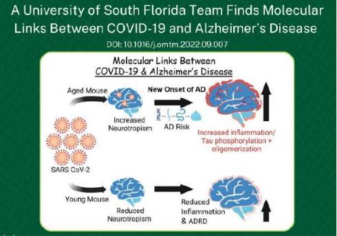 Graphic of Link between COVID-19 and Alzheimer's Disease