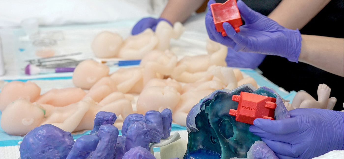 3D printing transforms how USF Health surgeons prepare for complex procedures