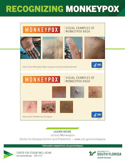 image of recognizing monkeypox flyer