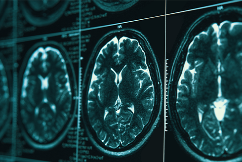 Black and blue glowing brain scan